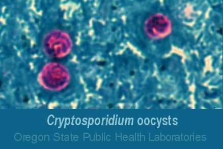 Cryptosporidium image