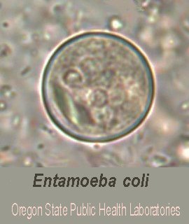 Entamoeba coli image