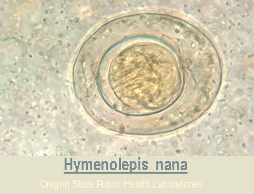 Hymenolepis-nana (Dwarf tapeworm) image