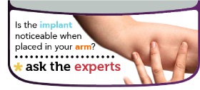 Is the implant noticeable in your arm?