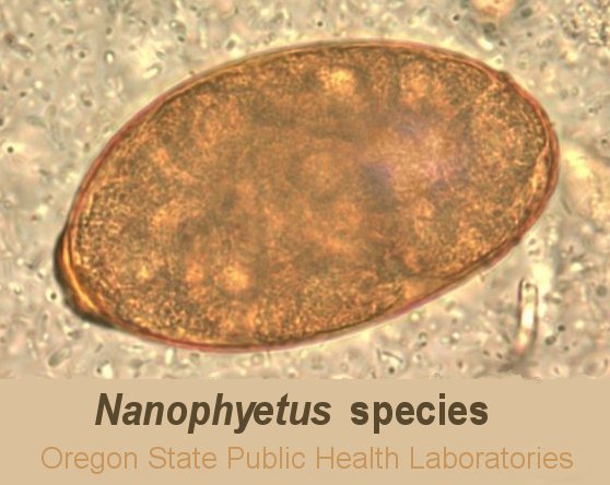 Nanophyetus species