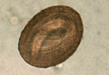 Baylisascaris Egg image
