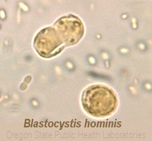 Blastocystis hominis image