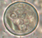 Entamoeba coli image