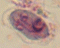 Trichrome cyst Giardia lamblia image