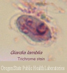 Trichrome cyst Giardia lamblia image