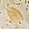 Giardia lamblia, trophozoite, wet mount (focal animation)
