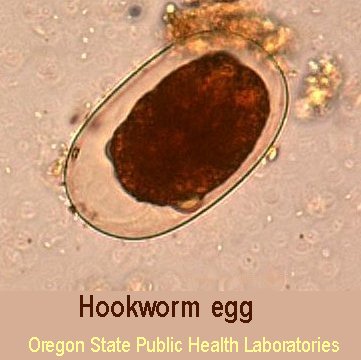 Hookworm egg