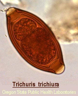 Trichuris trichiura (Whipworm)